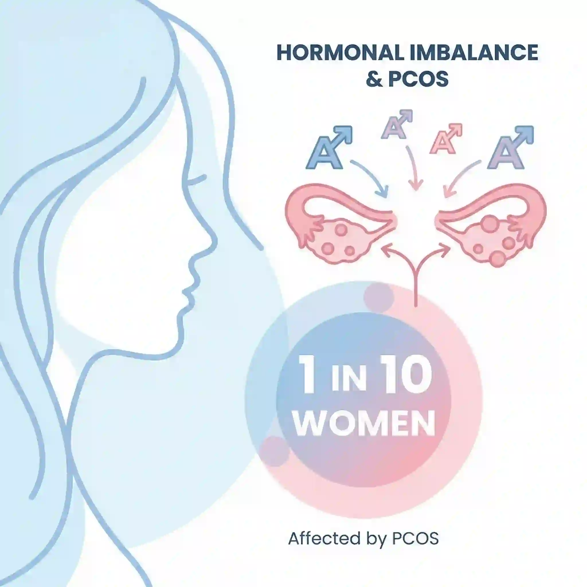 Causes of facial hair in women showing hormonal imbalances PCOS androgen levels and genetic factors for hirsutism
